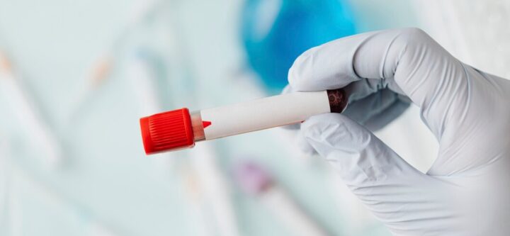 Hematology Hematology