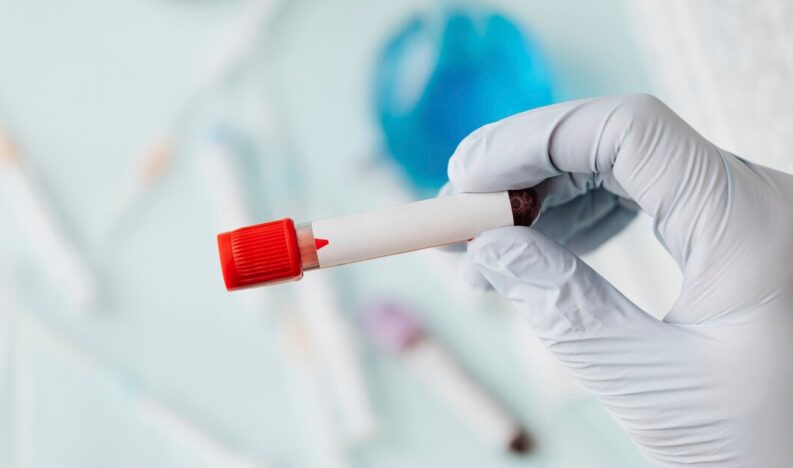Hematology Hematology