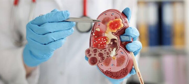 Nephrology Nephrology